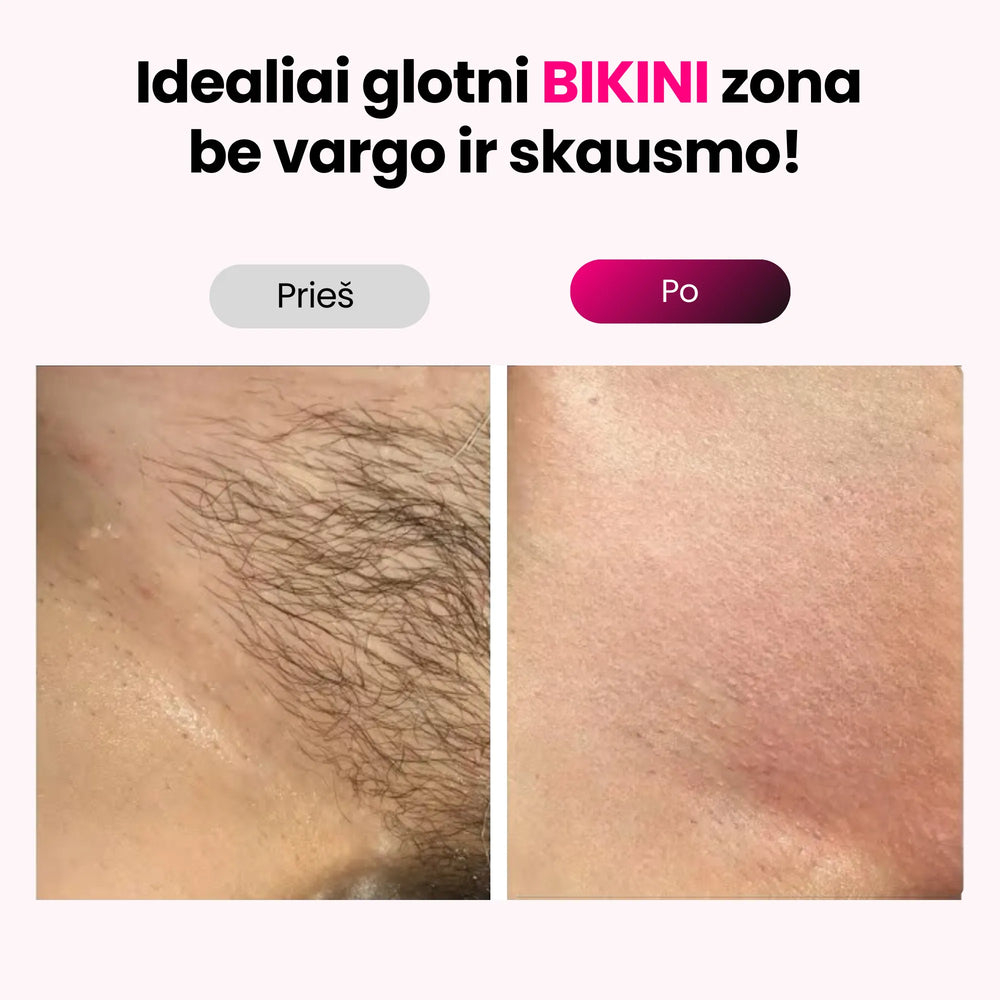 Elumi™ IPL plaukelių šalinimo rinkinys